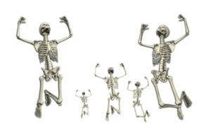 Skeletons Celebrating with DXA report