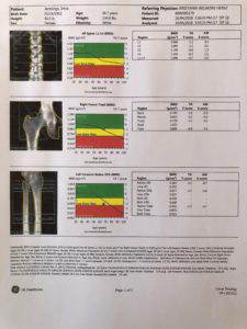 DXA spine hip forearm