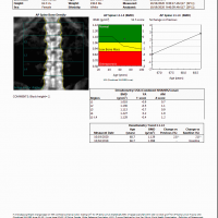 DXA test Spine 2020 (1)