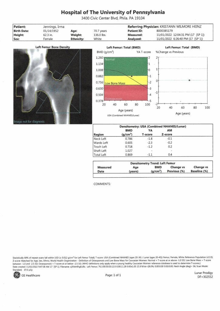 DXA to measure bone density of hip